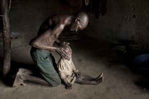 Fotografía del reportaje 'Un mal misterioso' que afecta los cráneos de niños de Uganda. Frederic Noy.